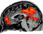 Forum of resting-state fMRI 